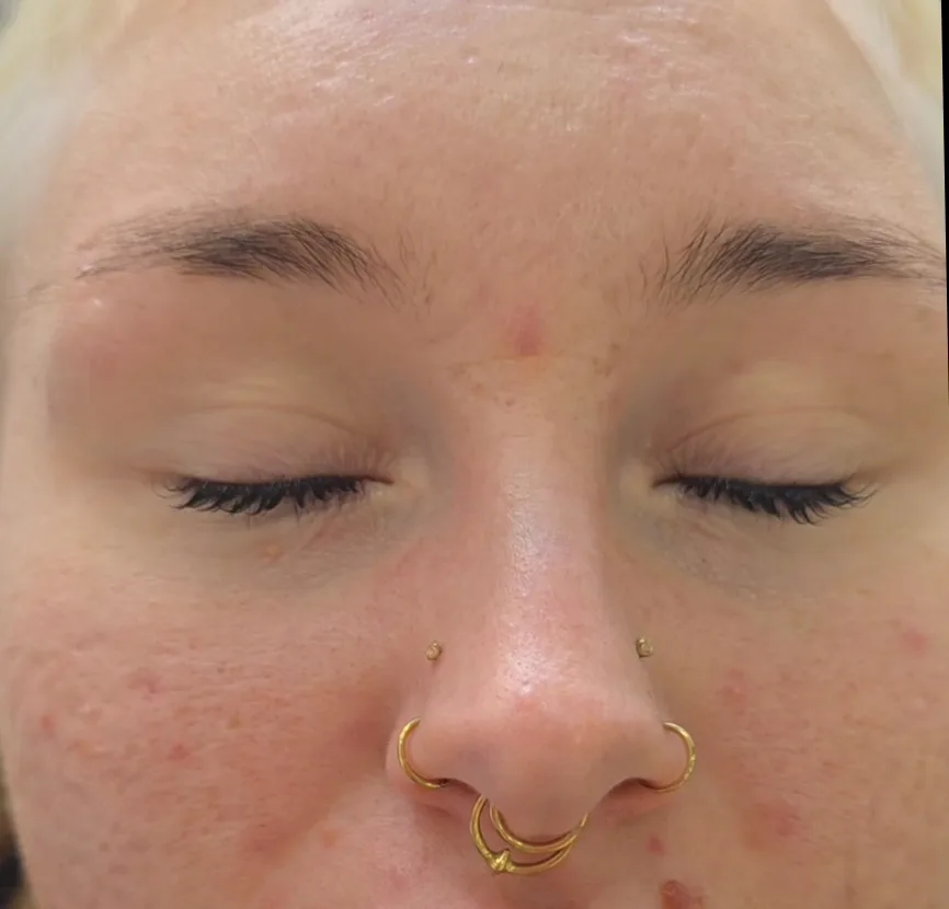 Close brow result at Shape's Thornbury